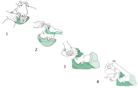 Manual Resuscitator Ambu Bag